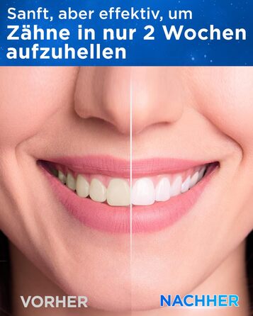 Електрична зубна щітка зі звуковими вібраціями, 8 насадок (3 типи), таймер, 120 днів роботи від акумулятора, 5 режимів чищення, чохол для подорожей, зарядний пристрій для стіни, синій колір