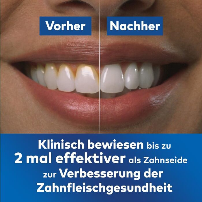 Waterpik Advanced Бездротова Іригатор для Рота, Тестер-Переможець 2024, Технологія Precision Pulse, До 99,9% Видалення Нальоту, 4 Насадки, 3 Режими, Індукційна Зарядка, Білий (Cordless Advanced Blue)