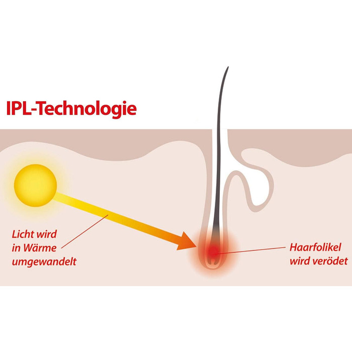 Епілятор Sichler Beauty IPL для видалення волосся, 5 режимів, насадка зі світлом, захисні окуляри